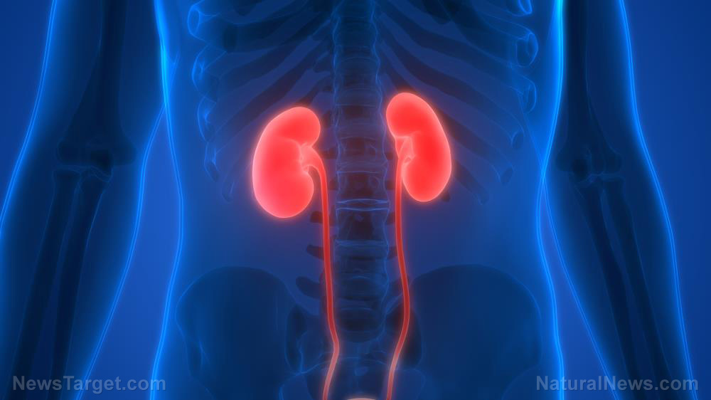 Kidney stones: Symptoms, treatments and dietary precautions