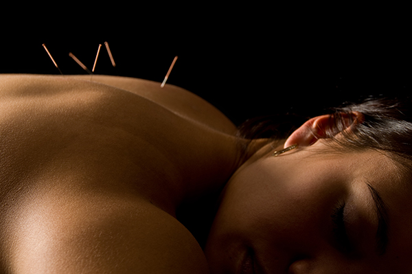 Science-backed health benefits of acupuncture