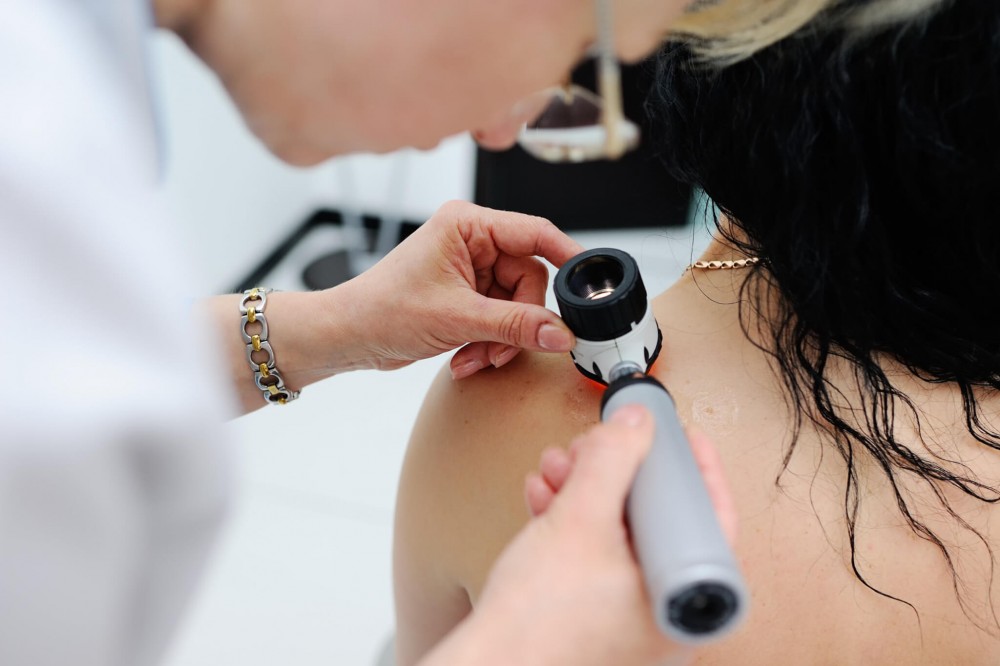 Doctor looking at patient's mole for melanoma screening